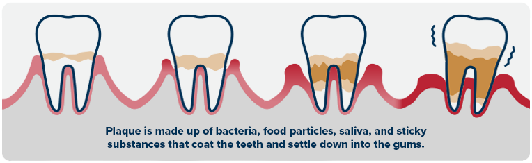 ps-dental-infographic-2-EN.png